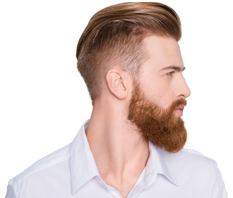 Beard Transplant